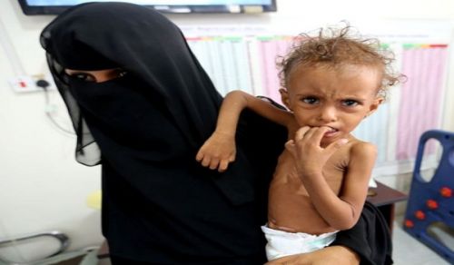 Yemen: Questions that everyone should ask himself!