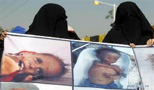 The Children of Yemen are Being Annihilated by a Senseless Brutal War While the World Watches on