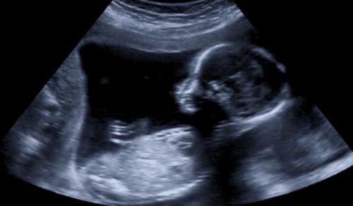 Capitalism Not in Position to Stop Student Pregnancies