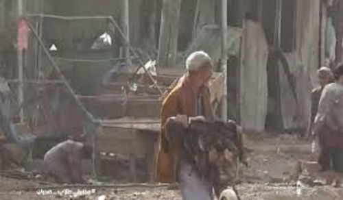 The Massacres against the Innocent People of Yemen  Offered as a Sacrifice by the Agent Rivals on the Doorsteps of the UN Council!!