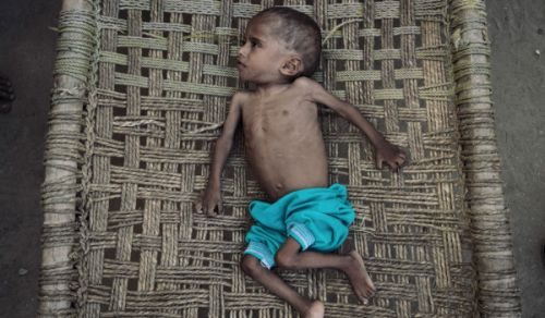 Famine is Ravaging the People of Yemen. What is the Fundamental Solution?