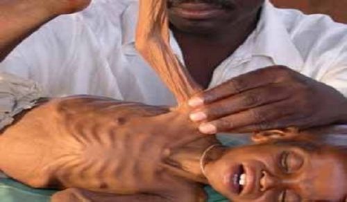 Leaders Race for Power while Citizens Die of Hunger
