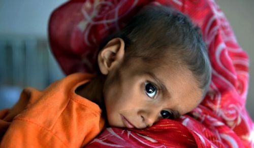 Babies are Born to Starve to Death in Afghanistan without the Khilafah!