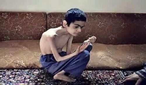 Who will Save the Starving Children of Madaya?