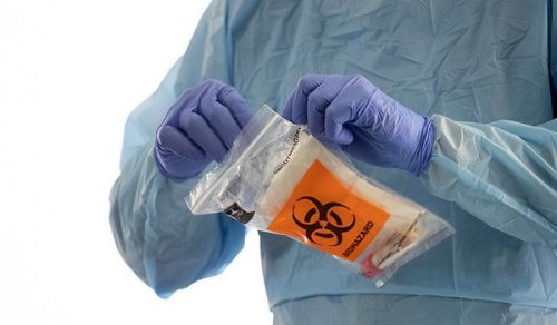 COVID-19 and the Disproportionate Number of Black Population affected by the Virus