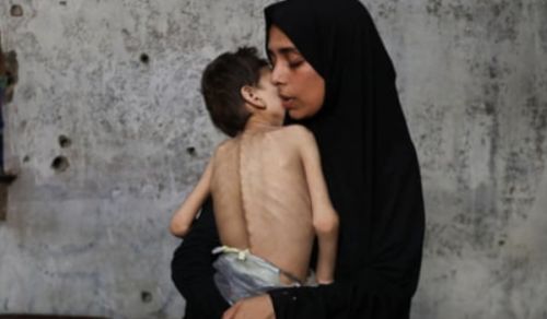 Gaza is Starving yet Muslim Leaders have Remained Deaf, Dumb and Blind!