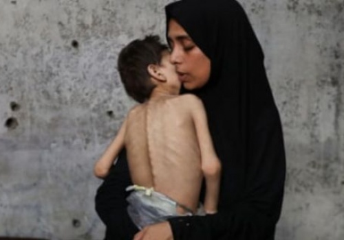Gaza is Starving yet Muslim Leaders have Remained Deaf, Dumb and Blind!